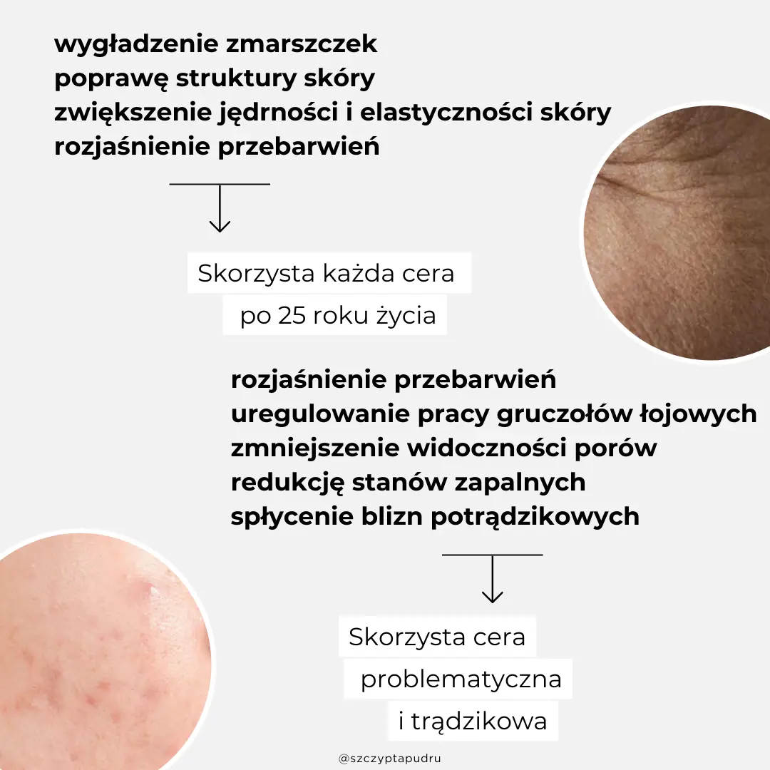 Retinol i Retinal w pigułce - jak zacząć, co trzeba wiedzieć, przeciwwskazania, z czym łączyć 1